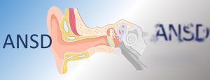 اختلال طیف نوروپاتی شنوایی (ANSD)